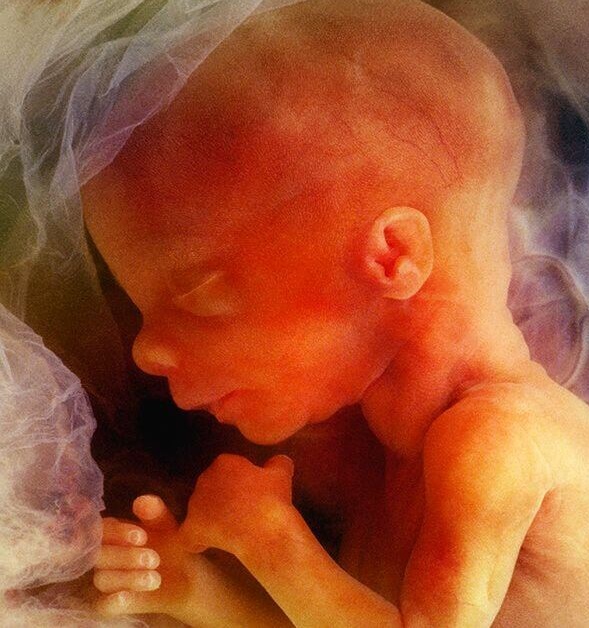 Governo maltês apresenta projecto de lei sobre o aborto até ao nascimento